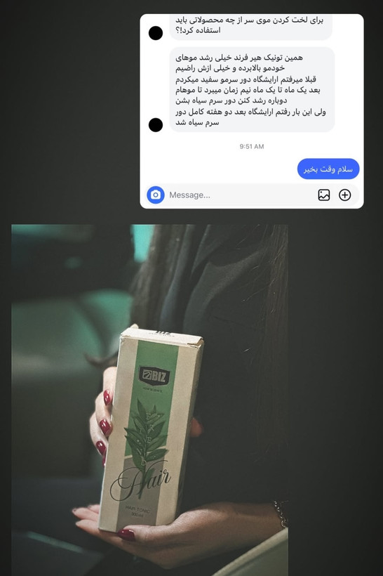 تونیک تقویت مو هیرفرند Hair Friend بیز مناسب مراقبت از موهای ضعیف و کمک به رشد بهتر مو
