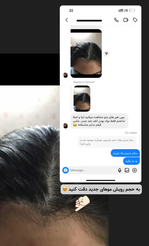 خرید آنلاین هیرفرند
