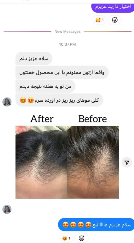 رضایت مشتریان از خرید تونیک تقویت مو هیرفرند بیز از فروشگاه لایجی